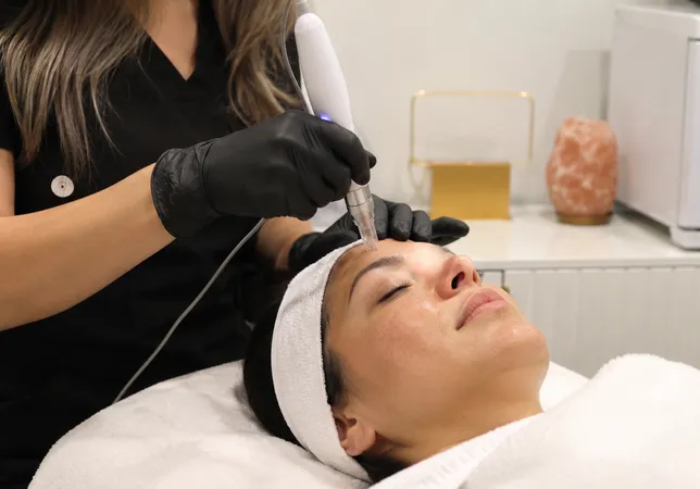 Skilled esthetician performing a microneedling treatment at 360 IV Infusion and Wellness in Prosper TX
